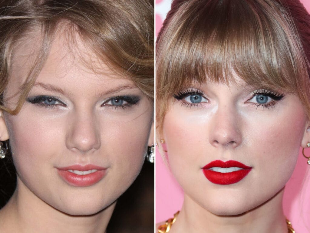 Taylor Swift Plastic Surgery